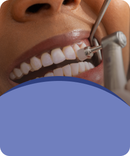 Professional Teeth Cleaning & Hygiene Care